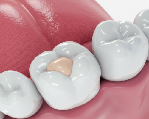 smiley-dental-waltham-colored-mobile