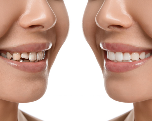 smiley-dental-waltham-full-mobile