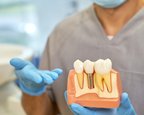 smiley-dental-waltham-implants-mobile