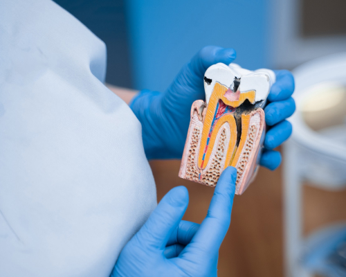 smiley-dental-waltham-root-mobile