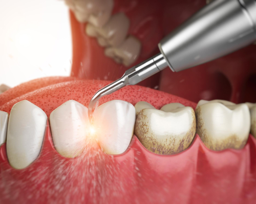 smiley-dental-waltham-therapy-mobile