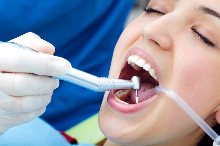 Teeth Reconstruction Guide