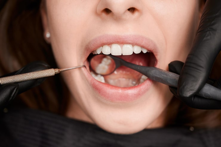 Teeth Reconstruction